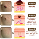 Black Rice Skin Repair Cream (Elimina verrugas e marcas, alivia psoríase, uniformiza a pele e reduz manchas)