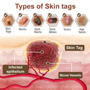 Black Rice Skin Repair Cream (Elimina verrugas e marcas, alivia psoríase, uniformiza a pele e reduz manchas)